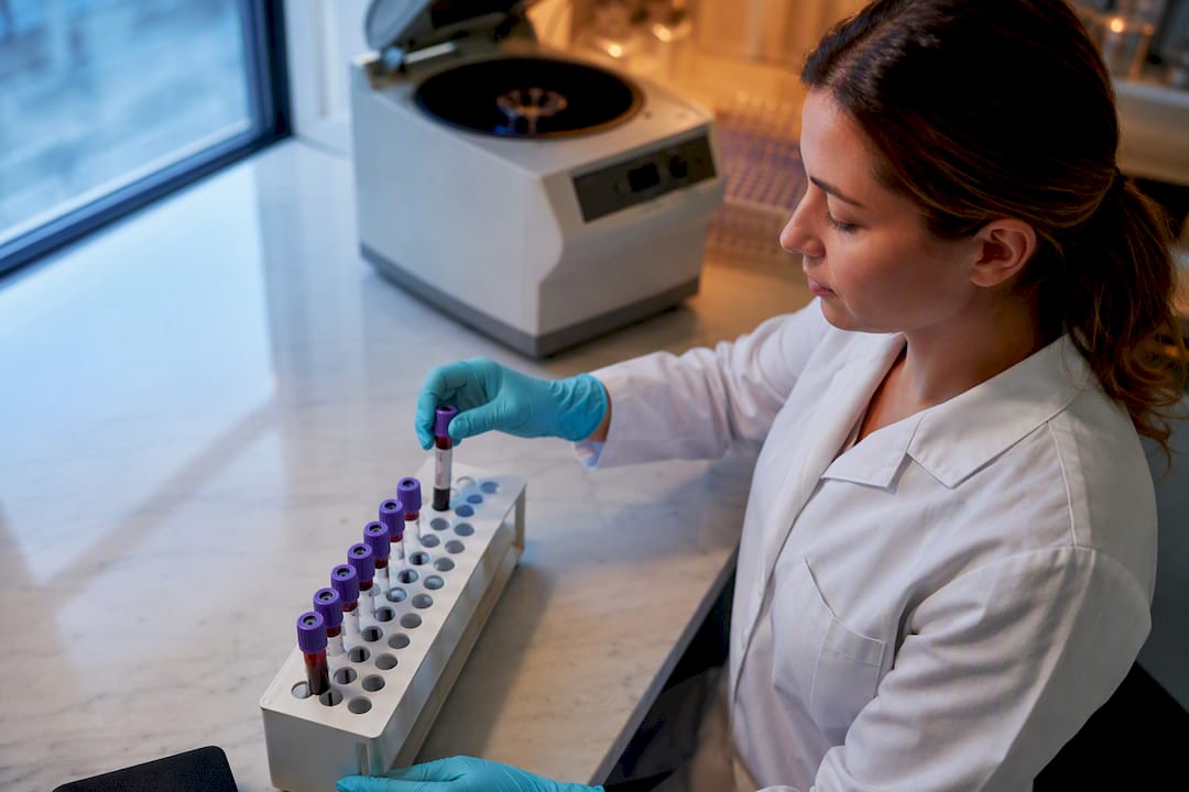 Blodprøverør i et biokemisk laboratorium